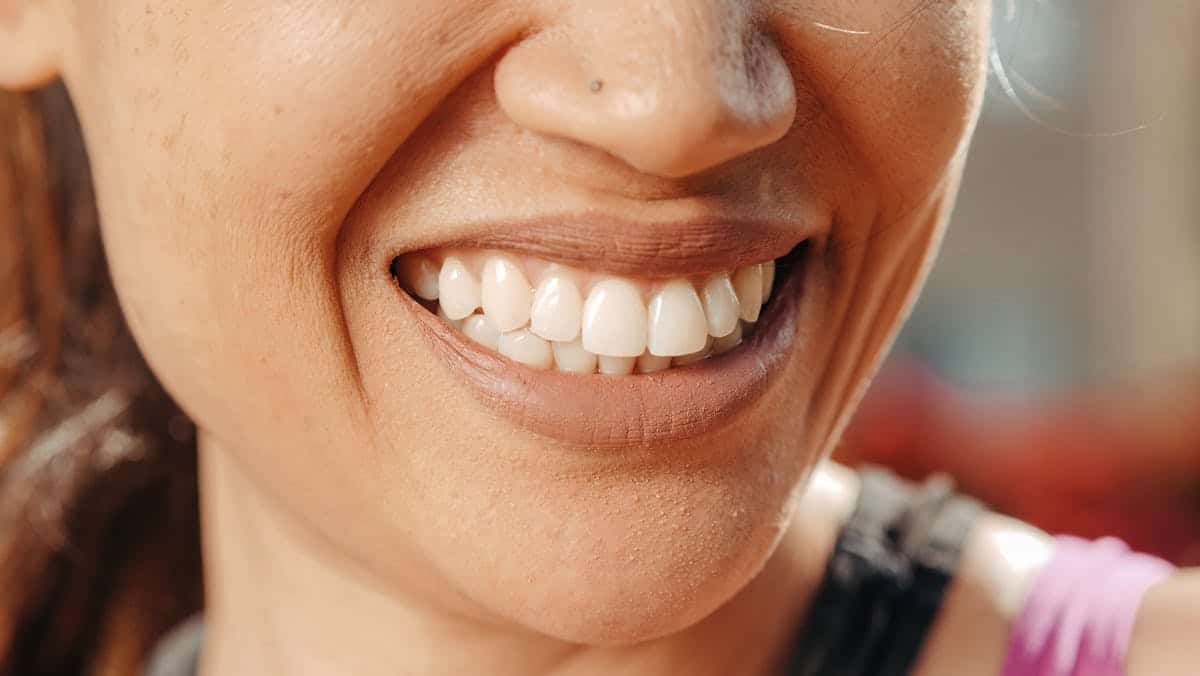 Smilelife Clínica Dental Madrid