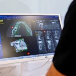 Escáner intraoral en Clínica Dental Smilelife