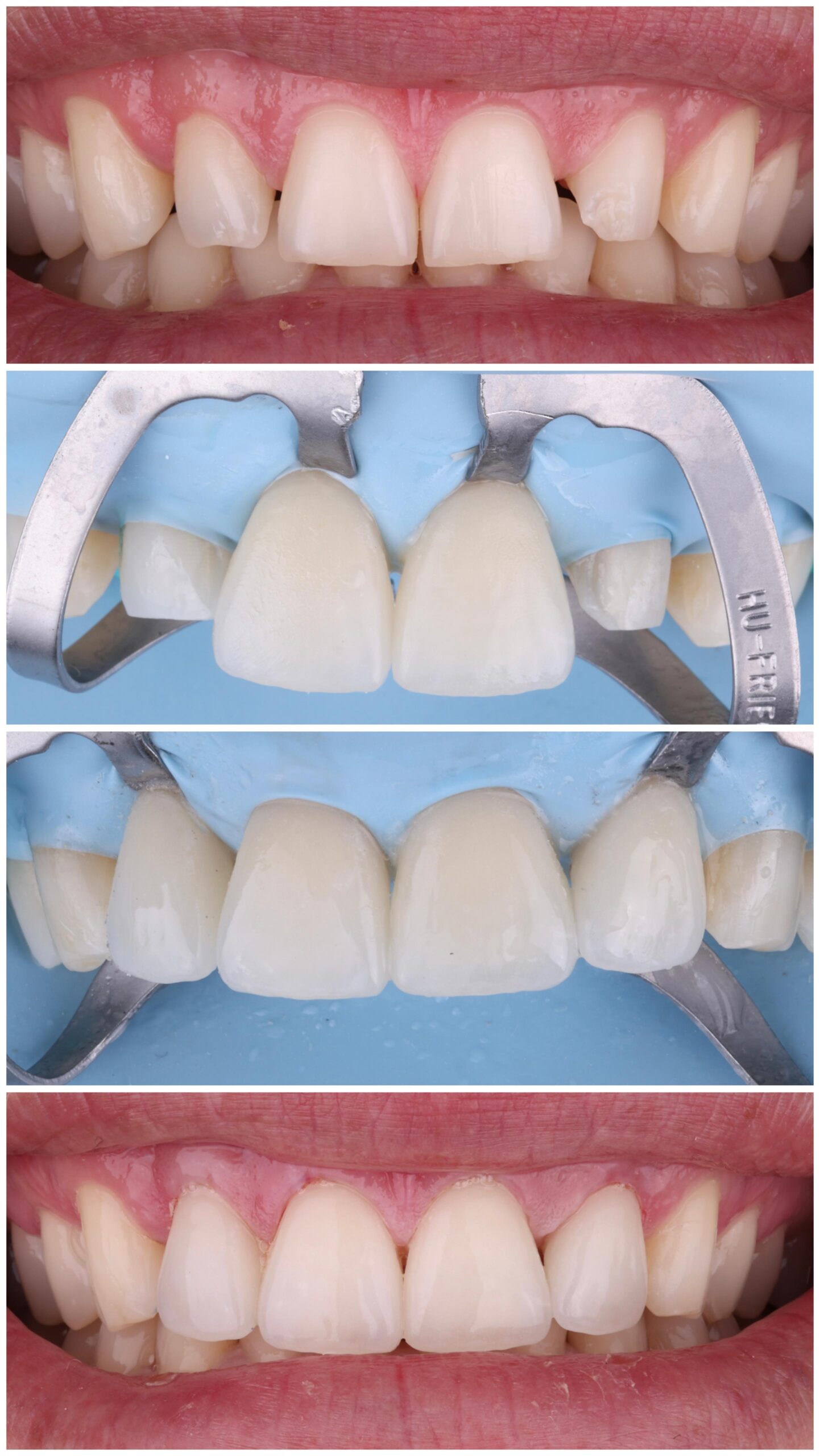 Estética dental Smilelife