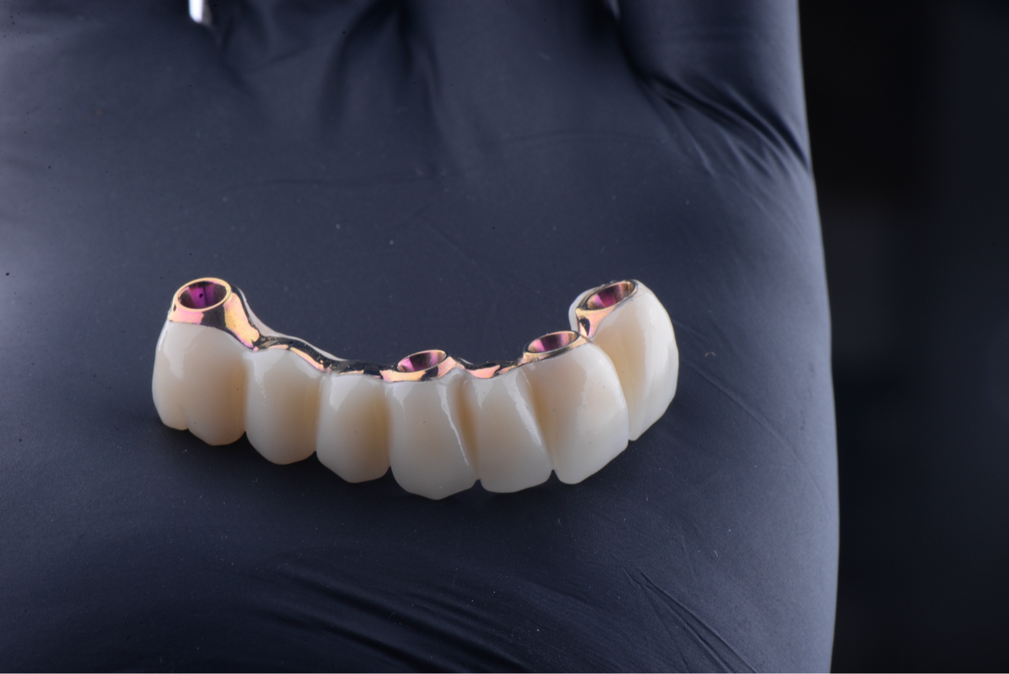Barra blender titanio zirconio vista cenital Smilelife Madrid