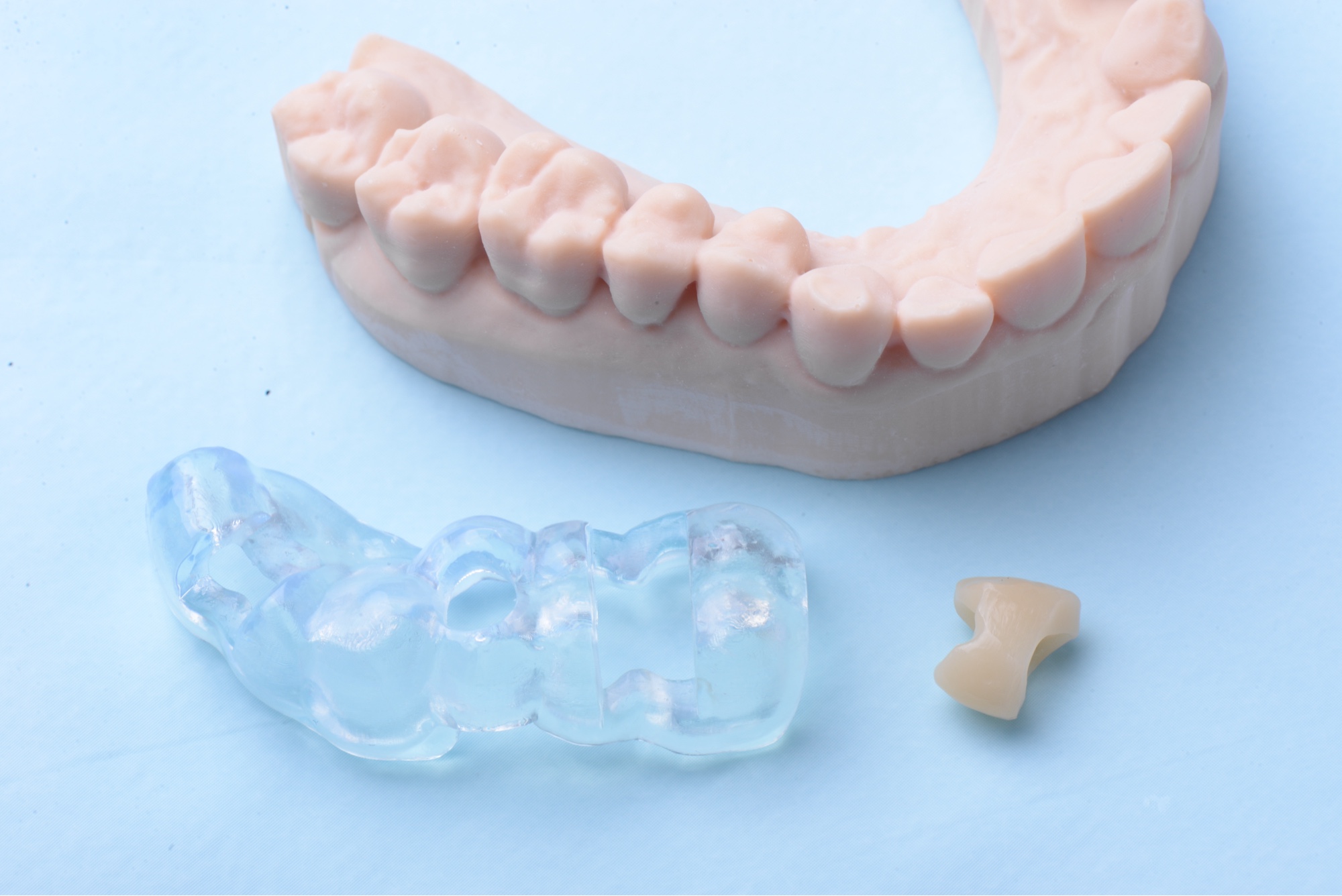 Férula quirúrgica para cirugía guiada de implantes dentales — Smilelife Madrid