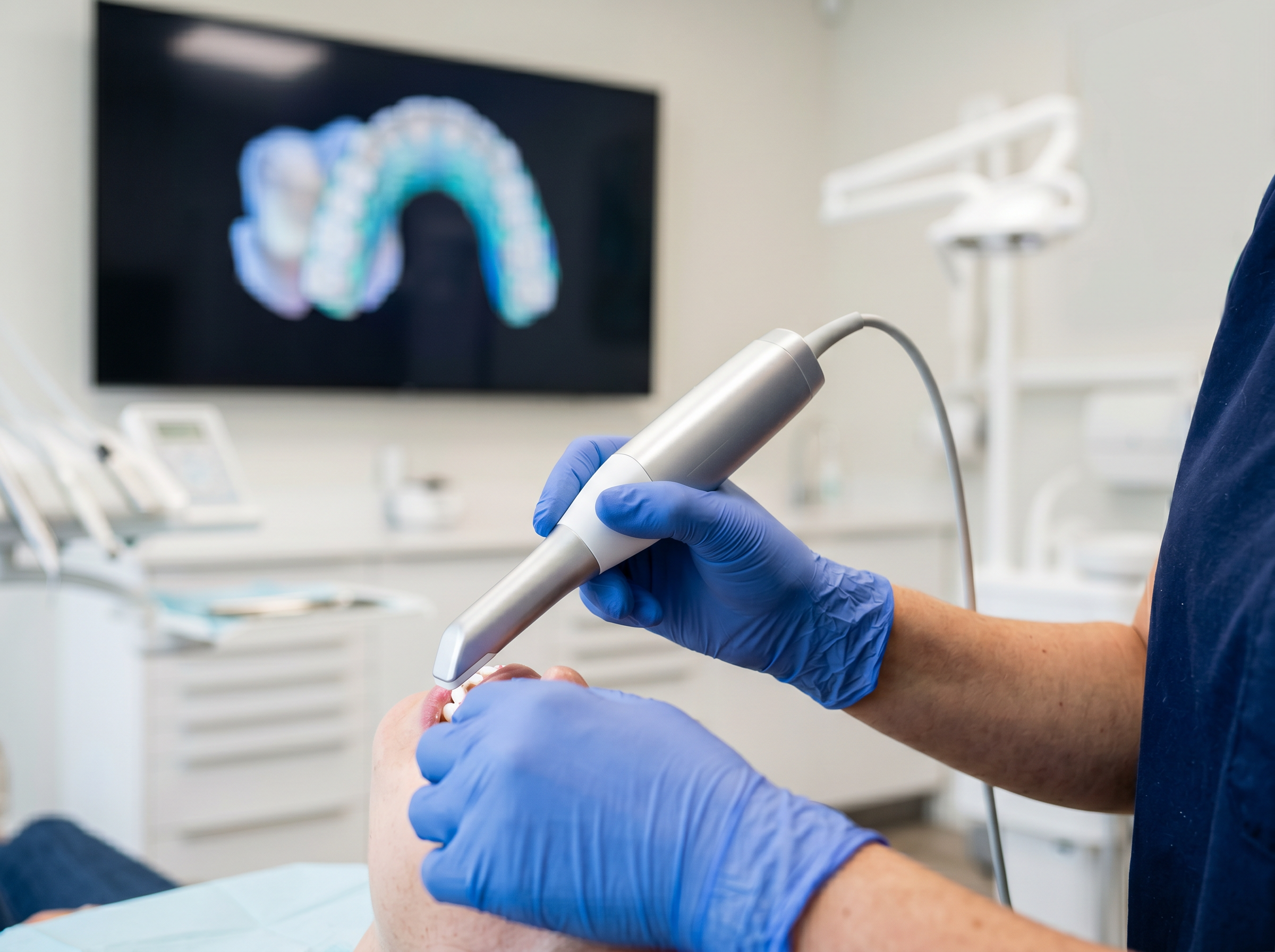 estetica dental alta gama Madrid Smile Life Madrid